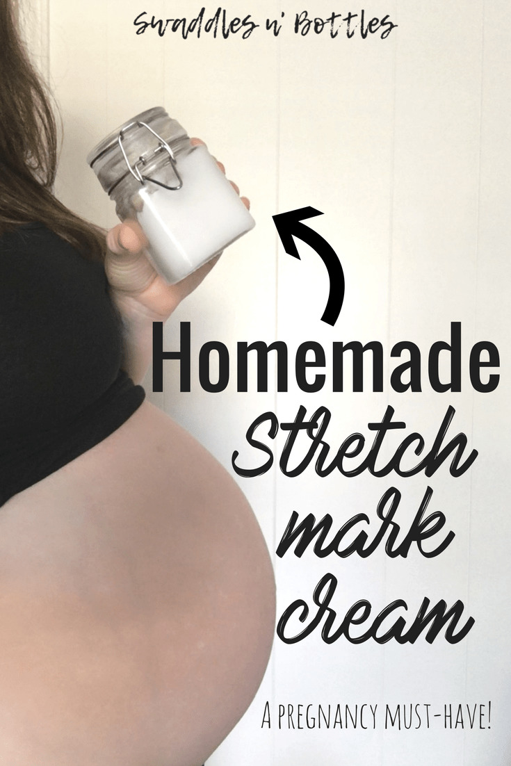 Homemade stretch mark prevention cream for pregnancy