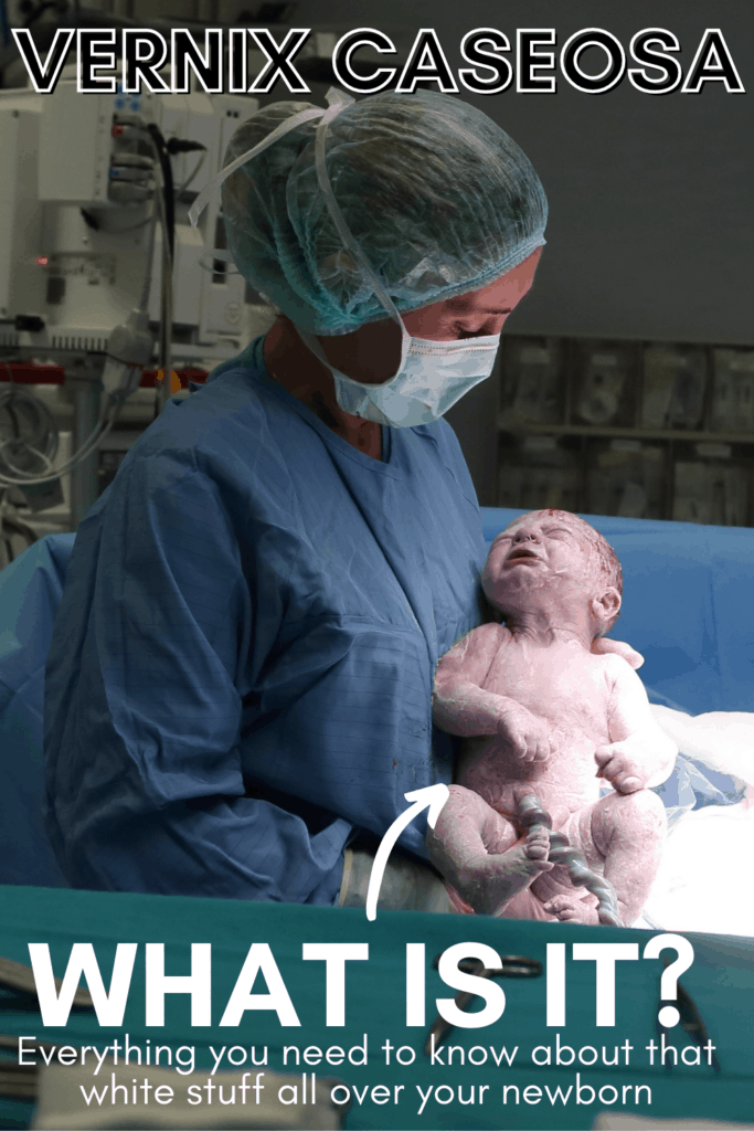 Vernix Caseosa: What is it? How does it benefit baby?
