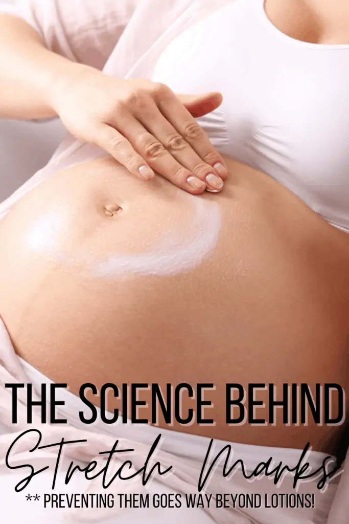 the science behind stretch marks and how to prevent them. A lot of it plays into genetics but there are still steps you can take to reduce the redness and itchiness they can cause