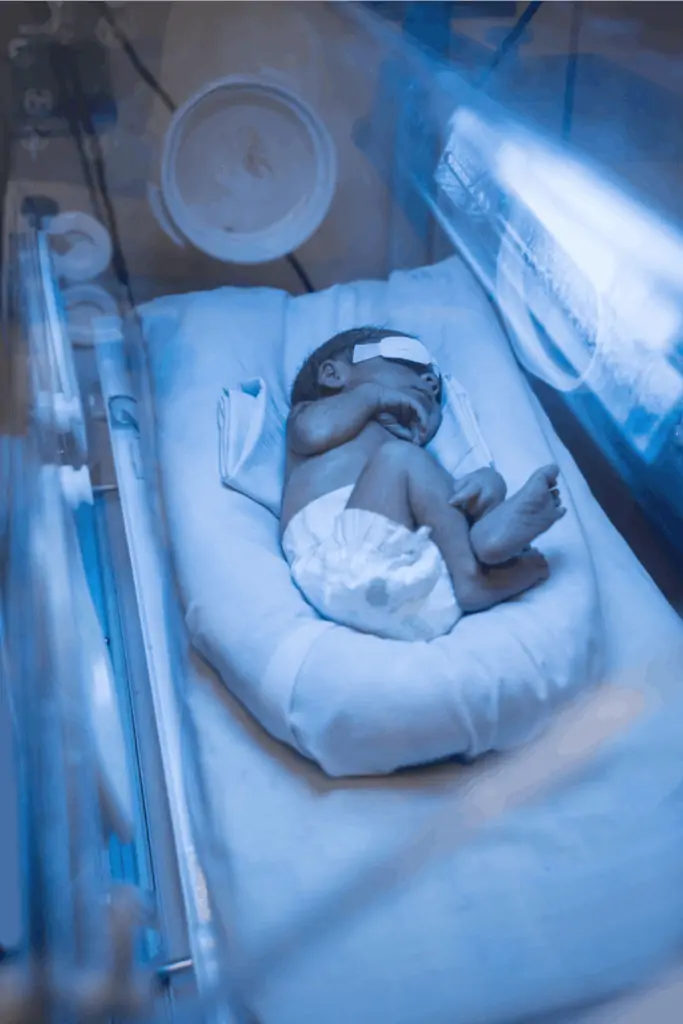 Research shows that every 6 of 10 newborns develop jaundice. It is an easily treatable condition. Here are the signs to look for in your newborn baby