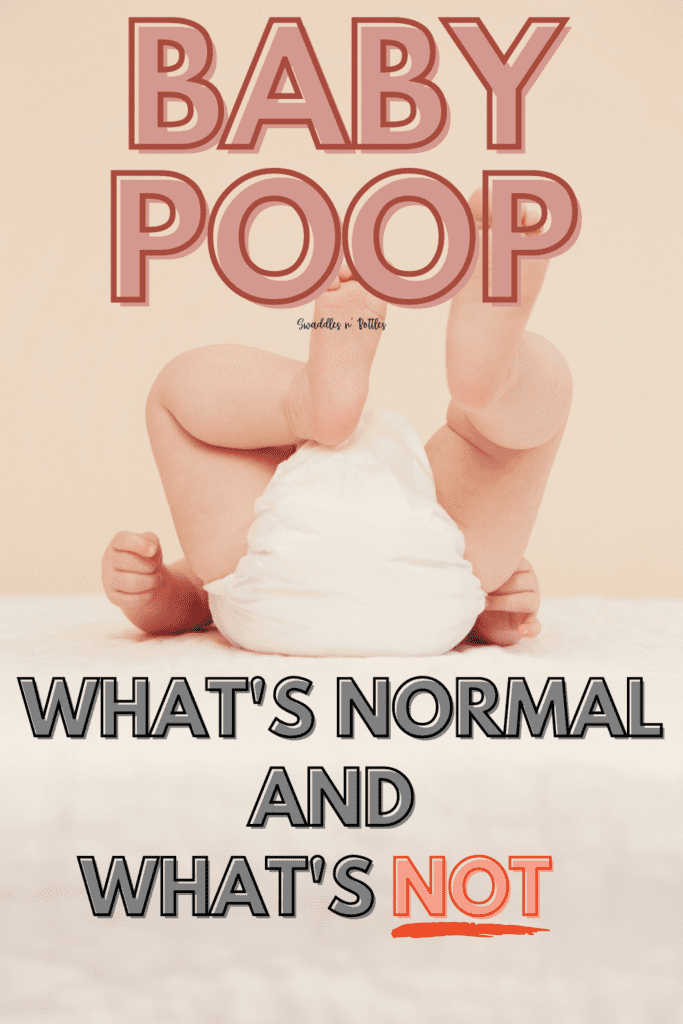 Baby Poop: What’s Normal and What’s Not